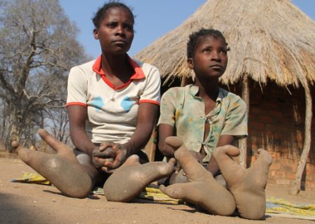 یک قبیله آفریقایی با پاهای عجیب و غریب اما واقعی! (+عکس)