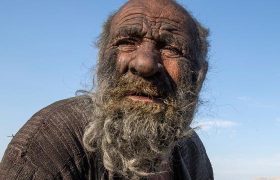 گزارش تصویری تی آر تی خبر از مردی که ۶۷ سال حمام نکرد!