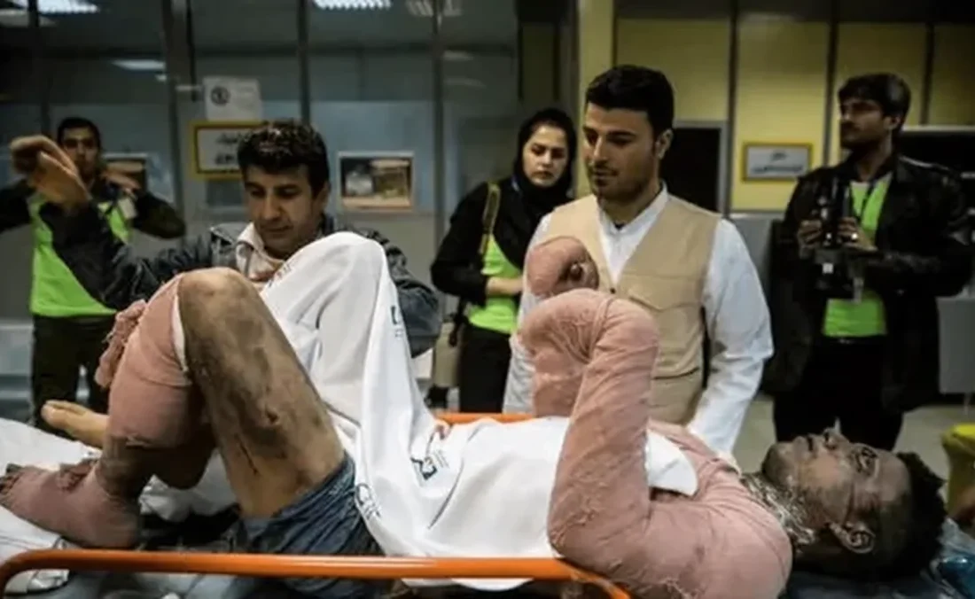 در ایران چند نفر بر اثر سوختگی جان خود را از دست می‌دهند؟