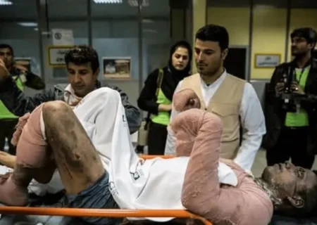 در ایران چند نفر بر اثر سوختگی جان خود را از دست می‌دهند؟